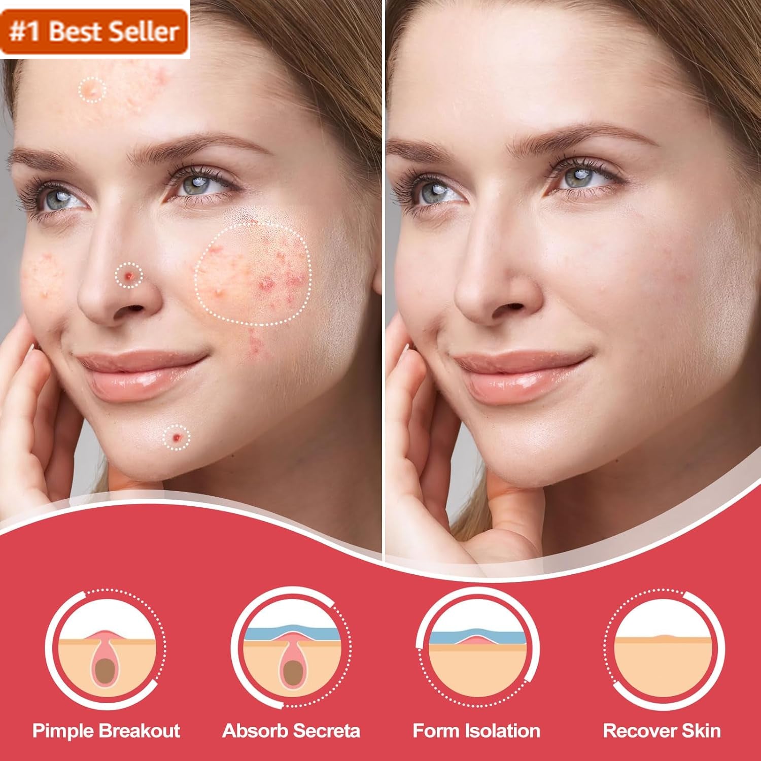 216 Counts Pimple Patches for Face, Hydrocolloid Acne Patches Zit Patches for Fa